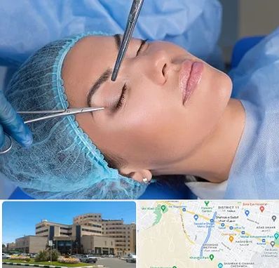 جراحی لیفت ابرو در صیاد شیرازی مشهد