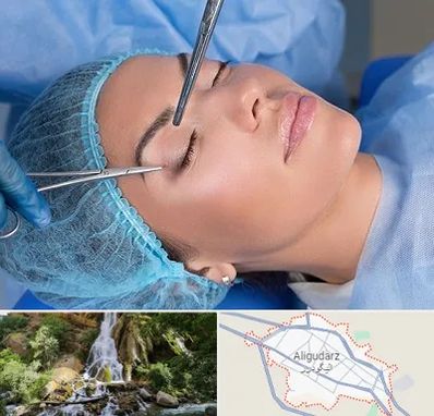 جراحی لیفت ابرو در الیگودرز