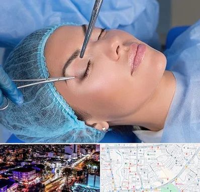جراحی لیفت ابرو در منظریه رشت