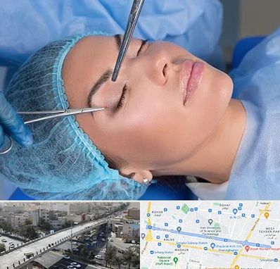جراحی لیفت ابرو در فرجام