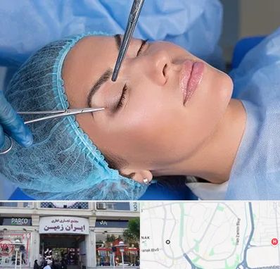 جراحی لیفت ابرو در ایران زمین