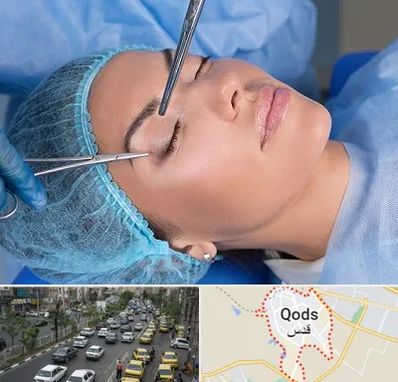 جراحی لیفت ابرو در شهر قدس