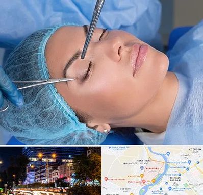 جراحی لیفت ابرو در کیانپارس اهواز