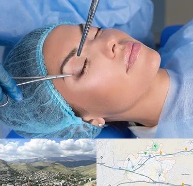 جراحی لیفت ابرو در رودهن