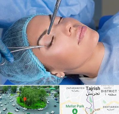 جراحی لیفت ابرو در تجریش 