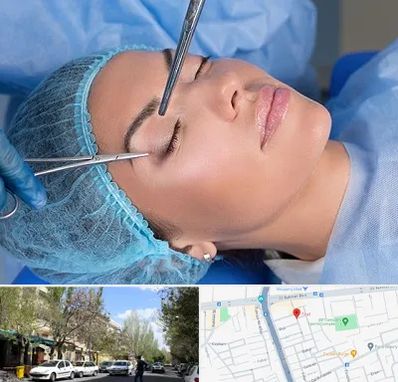 جراحی لیفت ابرو در کوی فیروز تبریز