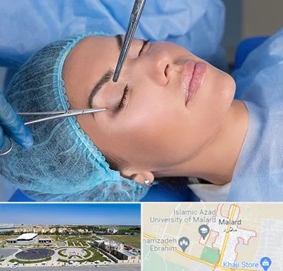 جراحی لیفت ابرو در ملارد