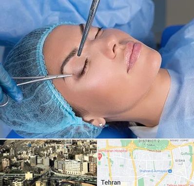 جراحی لیفت ابرو در مرزداران 