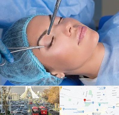 جراحی لیفت ابرو در خیابان آزادی 