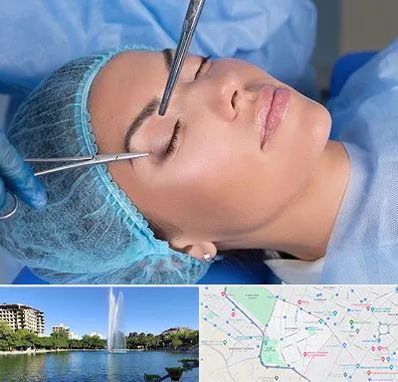 جراحی لیفت ابرو در کوهسنگی مشهد