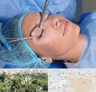 جراحی لیفت ابرو در منطقه 13 تهران 