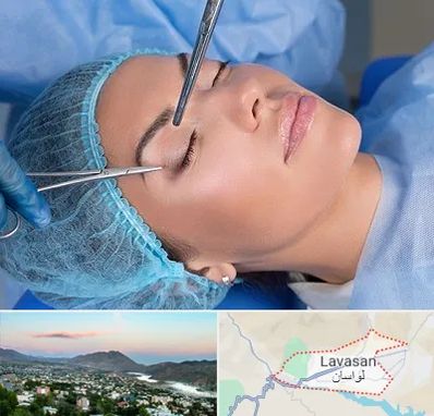 جراحی لیفت ابرو در لواسان
