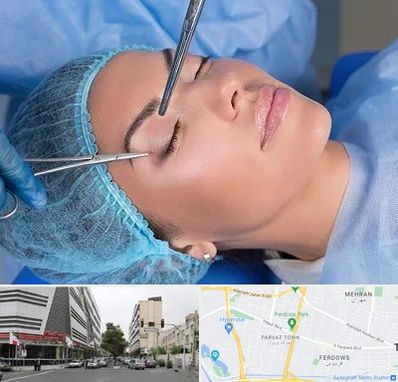 جراحی لیفت ابرو در بلوار فردوس 