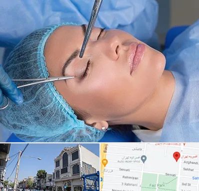 جراحی لیفت ابرو در افسریه 