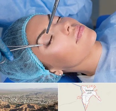 جراحی لیفت ابرو در اسفراین