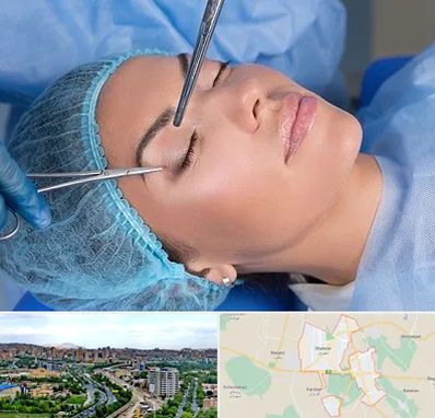جراحی لیفت ابرو در شهریار