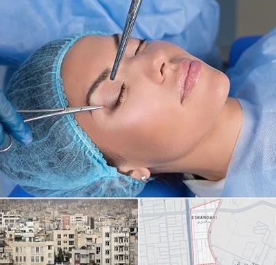 جراحی لیفت ابرو در اسکندری