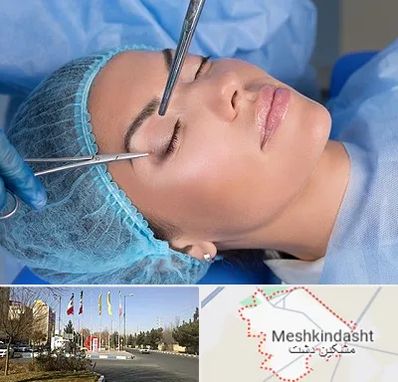 جراحی لیفت ابرو در مشکین دشت