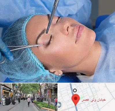 جراحی لیفت ابرو در ولیعصر شهریار