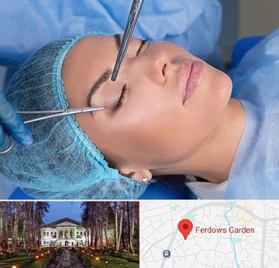 جراحی لیفت ابرو در باغ فردوس