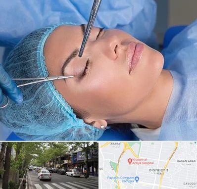 جراحی لیفت ابرو در ظفر 