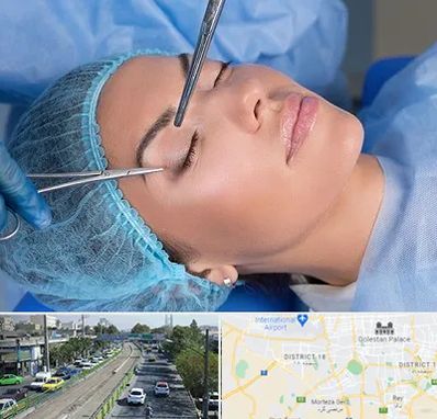 جراحی لیفت ابرو در جنوب تهران 