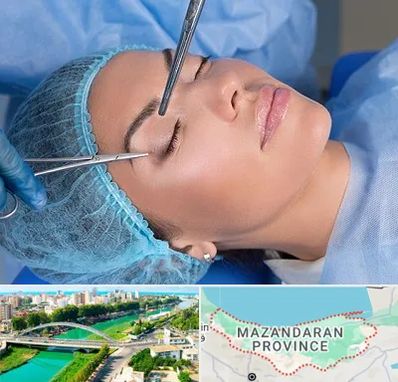 جراحی لیفت ابرو در مازندران