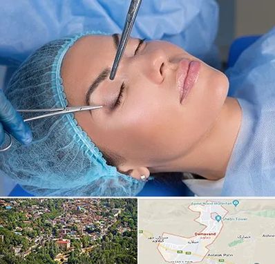 جراحی لیفت ابرو در دماوند