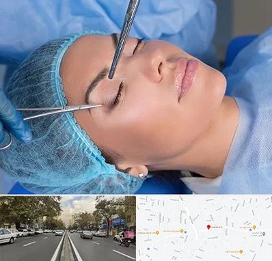 جراحی لیفت ابرو در دولت