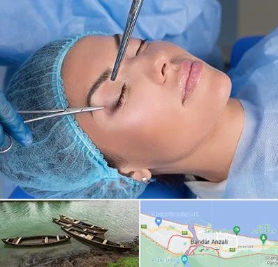 جراحی لیفت ابرو در بندر انزلی