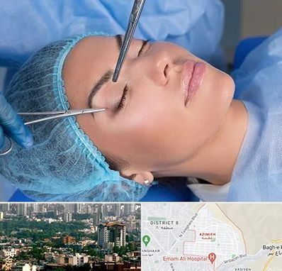جراحی لیفت ابرو در عظیمیه کرج 