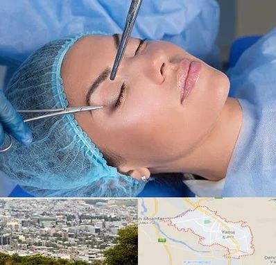 جراحی لیفت ابرو در یاسوج