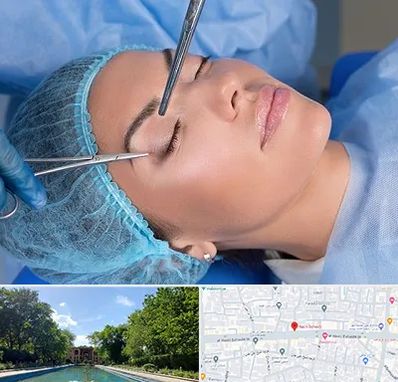 جراحی لیفت ابرو در هشت بهشت اصفهان