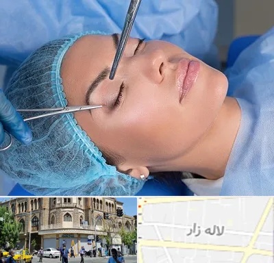جراحی لیفت ابرو در لاله زار