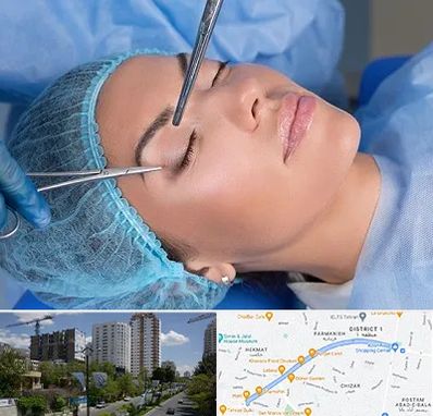 جراحی لیفت ابرو در اندرزگو