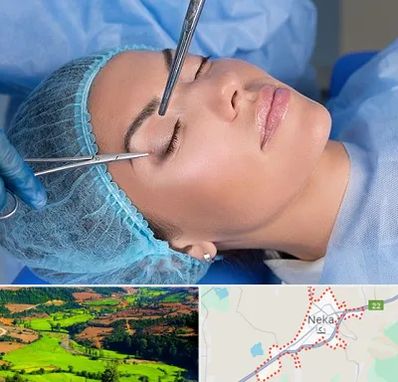 جراحی لیفت ابرو در نکا