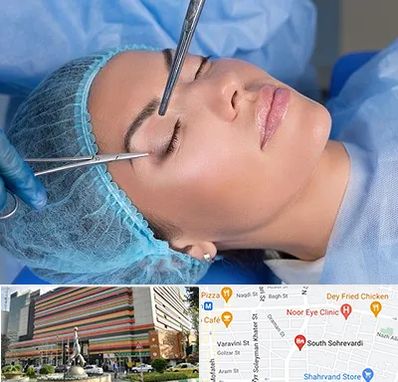 جراحی لیفت ابرو در سهروردی 