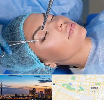 جراحی لیفت ابرو در غرب تهران 