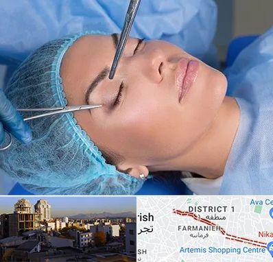 جراحی لیفت ابرو در فرمانیه 