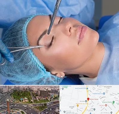 جراحی لیفت ابرو در سبلان 