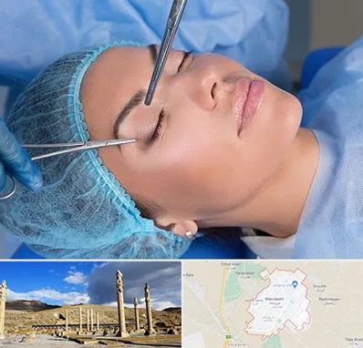 جراحی لیفت ابرو در مرودشت