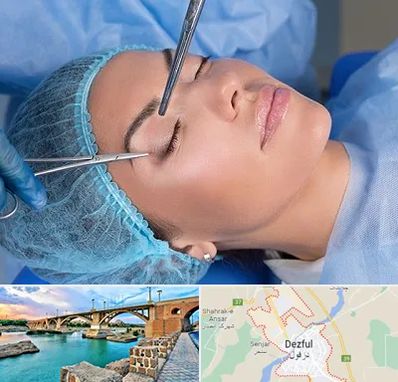 جراحی لیفت ابرو در دزفول