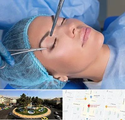 جراحی لیفت ابرو در هفت حوض 