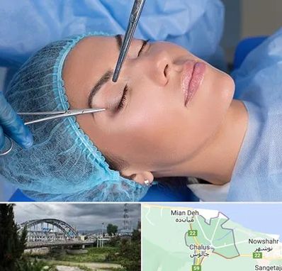 جراحی لیفت ابرو در چالوس