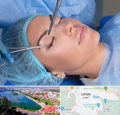 جراحی لیفت ابرو در لاهیجان