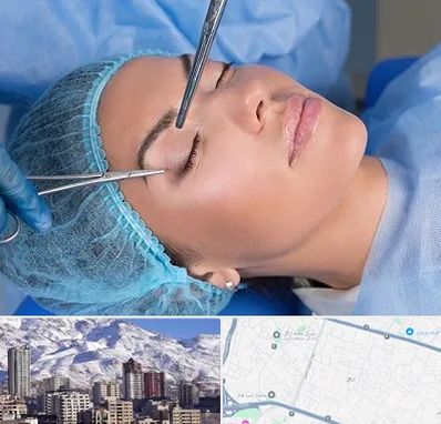جراحی لیفت ابرو در ازگل