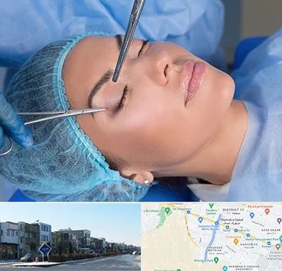 جراحی لیفت ابرو در شریعتی مشهد