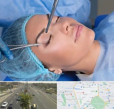 جراحی لیفت ابرو در منطقه 17 تهران 