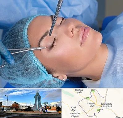 جراحی لیفت ابرو در تایباد
