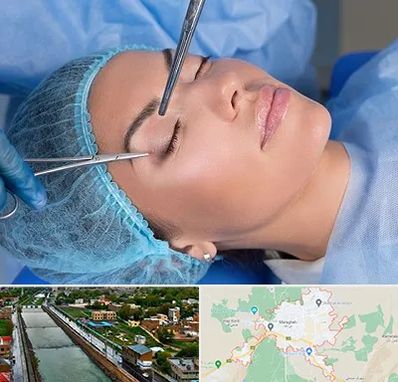 جراحی لیفت ابرو در مراغه